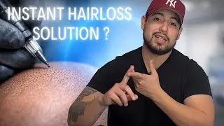 scalp micro pigmentation the instant hair loss  solution (everything you need to know )