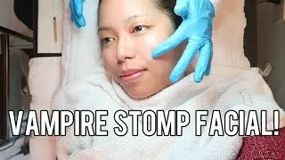 VAMPIRE STOMP FACIAL (REVIEW) - saytioco