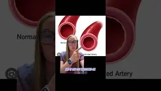 Did you know that smoking is bad for your spine? Full video pinned in comments #spinehealth #smoking
