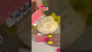 FRUIT YOU CAN AND CAN'T EAT WITH BRACES ON 😳 🍇 ORTHODONTIST REACTS 🦷👀