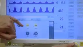 I:E setting on a Draeger ventilator
