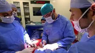 Promo video for patients coming from UK to have surgery abroad