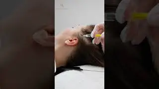 Exosomes Therapy Explained | The Future of Skin & Hair Regeneration