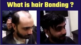 What is Hair Bonding ? +91 9900170130 WIG DESIGNS INTERNATIONAL in Bangalore INDIA