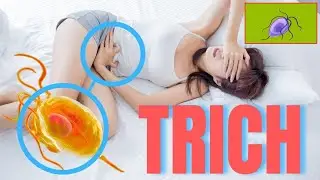 What are the causes of Trichomoniasis in Females | Diagnosis & Fast Treatment Guide