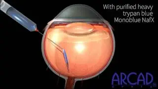 Why the operation using purified heavy trypan blue MONOBLUE NafX is more efficient ?