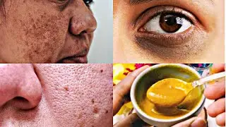 How To Repair Damage Skin At Home | Use This Mask & Get Spotless, Healthy, Glowing Skin Instant
