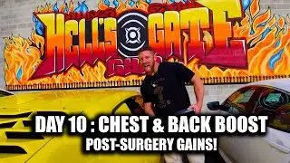 Day 10: Chest & Back Boost! 💪💥 Post-Surgery Gains!