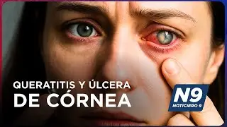Queratitis Y &Uacute;lcera De C&oacute;rnea