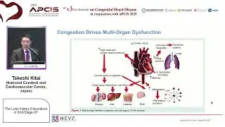 The Liver-Kidney Conundrum in End-Stage HF