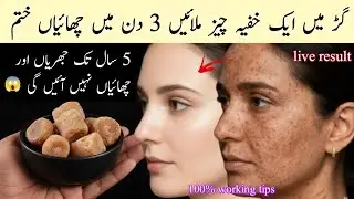10-year-old dark spots ❣️Aunt's disappeared in just 2 days with jaggery, and she also became fair 😍