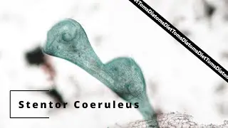 Stentor Coeruleus Splitting