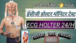 ecg holter monitor test // holter test results // holter monitor 24 hours//heart holter test//#viral