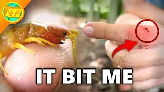 THIS is what happens when a CENTIPEDE BITES You&hellip;