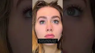 HALO after-care Ferulic Acid
