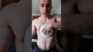 How to use the Vacuum Bell - Pectus Excavatum