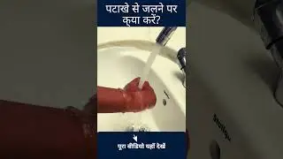 Patakhe se Jalne Par Kya Kare Firecracker Burn First Aid | Dr Karoon