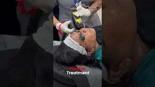 Tired of Unwanted Facial Hair?
