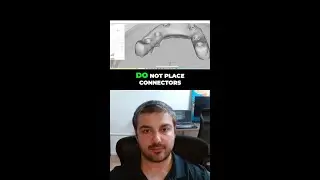 Why Connector Placement Can Make or Break Your Arch | Dental Lab Design Tips