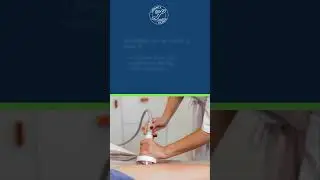 Unveiling the Science: How Focused Shockwave Therapy Works