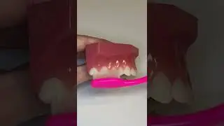 Are you brushing away your gums? Watch this video for tips to avoid gum recession when brushing.