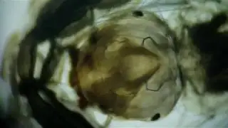 If you give an ape a microscope..