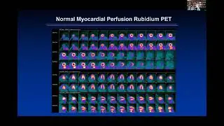 Cardiac PET&mdash;Solutions for Adoption