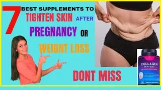 Discover 7 Best Supplements to Tighten Skin after Pregnancy or Weight loss