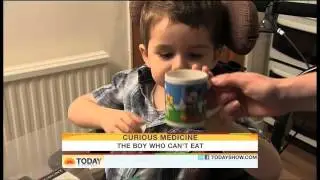 TODAY SHOW CURIOUS MEDICINE - The Boy Who Cant Eat