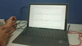 My Research PPG sensor Readout for AFib, Blood Flow Volume and Blood Pressure Estimation