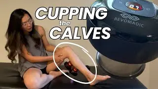 Calf Pain GONE with REVO Smart Cupper│Self-Cupping at Home