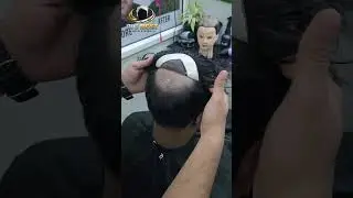 contact us 7289882941 best quality hair patch for men free demo and consultation available