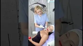 Dermapen &Pi;&rho;&omicron;&sigma;ώ&pi;&omicron;&upsilon; &Pi;&rho;&iota;&nu; &kappa;&alpha;&iota; &Mu;&epsilon;&tau;ά #dermapen #mesotherapy