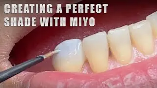 Creating a Perfect Shade with MiYO