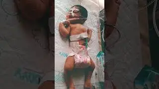@hemendrapartap9690#hospital #cutebaby #video #viral  #compounder  #desease # #newbornbaby