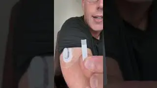 Extend Life of Dexcom G6 Indefinitely