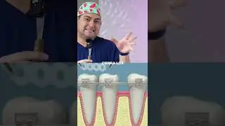 LIGAS de COLORES vs CADENAS y C&Oacute;MO te AFECTAN!