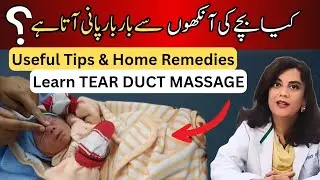 How to Massage Your Baby's Tear Ducts (With Pro Tips!)|Dr.Riffat Omer