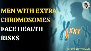 How Common Is It for Men to Have an Extra Chromosome? | WION Podcast