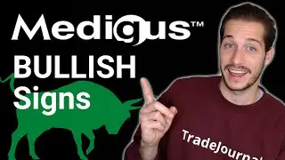 MDGS Stock Could Be A Buy IF We See This..