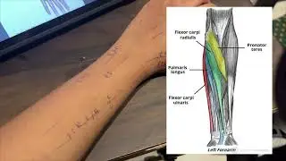 Cheat code for FOREARM muscles in just 5 mins #medical #forearm#muscle 