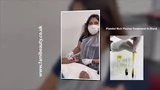 PRP (platelet-rich plasma) in Ilford uk , PRP in London