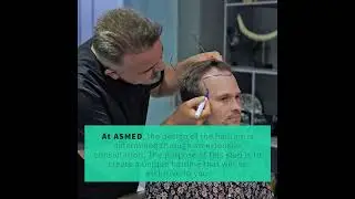 Hair Line Design - Asmed Hair Transplant Clinic, İstanbul-T&uuml;rkiye Dr. Koray Erdoğan