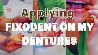 КАК Я ПРИМЕНЯЮ КЛЕЙ FIXODENT #протезы #длявас #маленькийютубер #fyp #немедленныепротезы