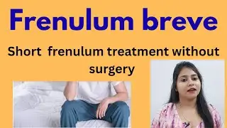 Short frenulum(Frenulum breve) treatment without surgery ! Tight frenulum symptoms,cause & medicines