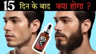 Beardo Godfather Lite Beard Growth Oil After 15 Days Review|Best Beard Oil For Patchy Beard in India