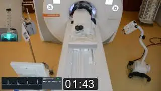 MRI Cardiac Stress Perfusion