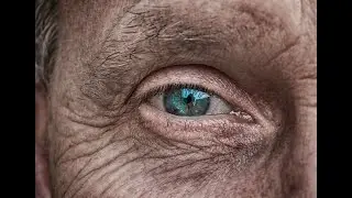 COVID-19 and conjunctivitis of the eye