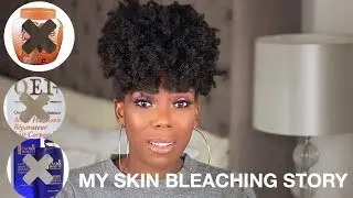 HOW I STOPPED BLEACHING: MY SKIN BLEACHING STORY INSPIRED BY JACKIE AINA