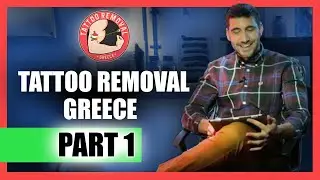 Αφαίρεση Τατουάζ - Tattoo Removal Gr | Ότι πρέπει να γνωρίζετε | Part 1 | Panos Georgoulias